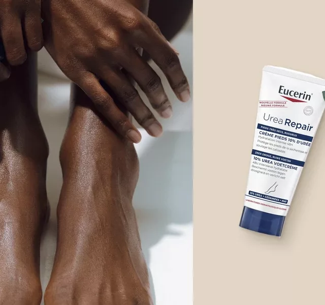 Pieds hydratés sur peau noire avec la crème pieds KOBA, et les crèmes Eucerin UreaRepair et KOBA Bottom Up contre les callosités